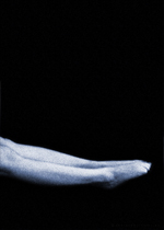 sierotik